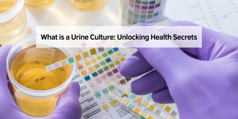 What is a Urine Culture