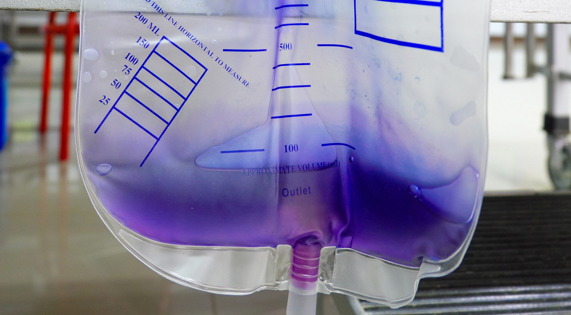 What Causes Purple Urine