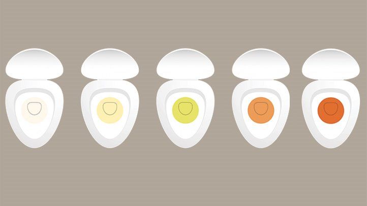 Why Does My Urine Smell