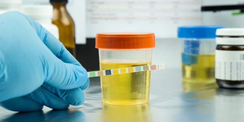 What Can Urine Tests Detect