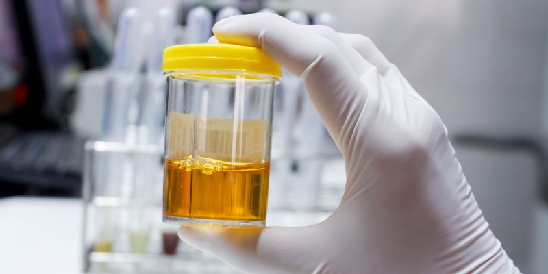 What Does It Mean If Your Urine Is Cloudy
