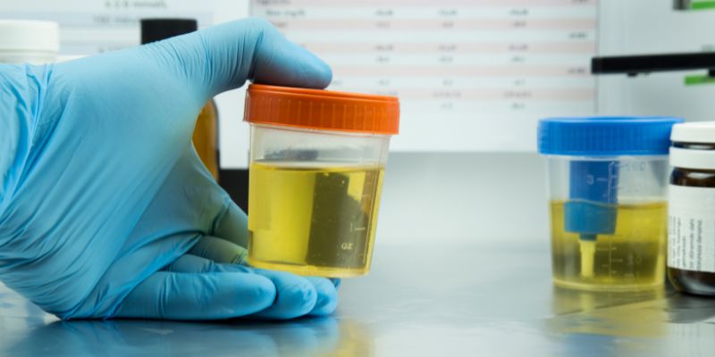 Why Urine Test Costs Matter for Homeowners
