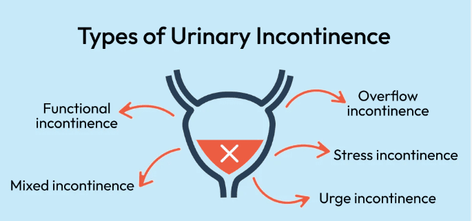 Types of Urinary Incontinence