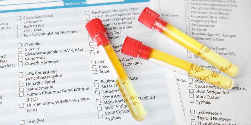 Does Tramadol Show Up On A Urine Drug Test
