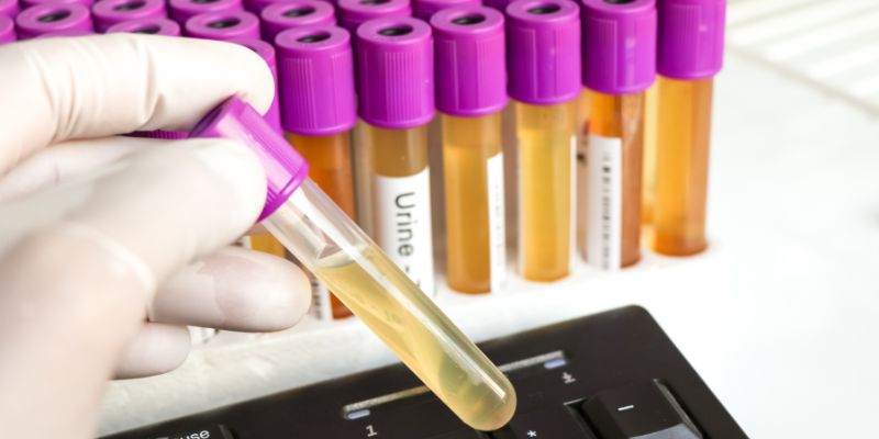 Personal Insights From My Experience