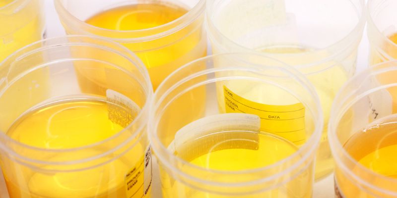 Is Drinking Urine Bad for You