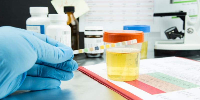 Step-by-Step Guide to Store Urine