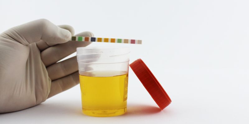 When Should You Worry About Foamy Urine