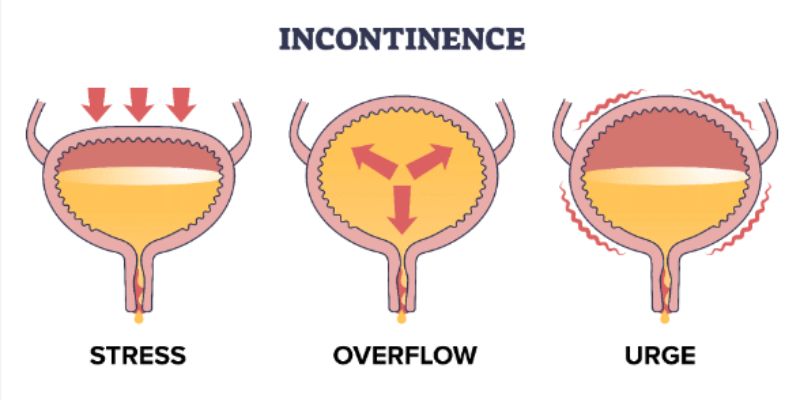 Why Do I Itch After Urinating