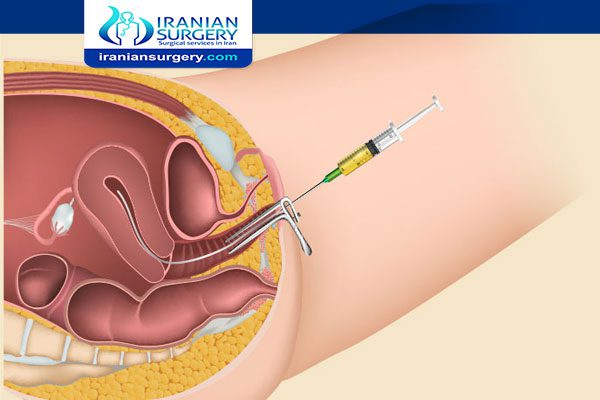 Does Urine Kill Sperm